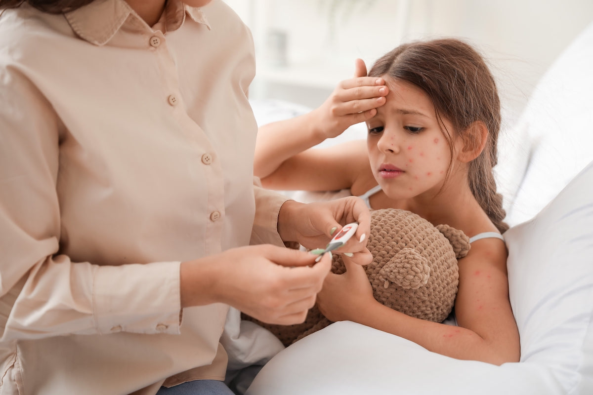 Kind liegt mit Windpocken im Bett, Mutter sitzt mit Thermometer daneben